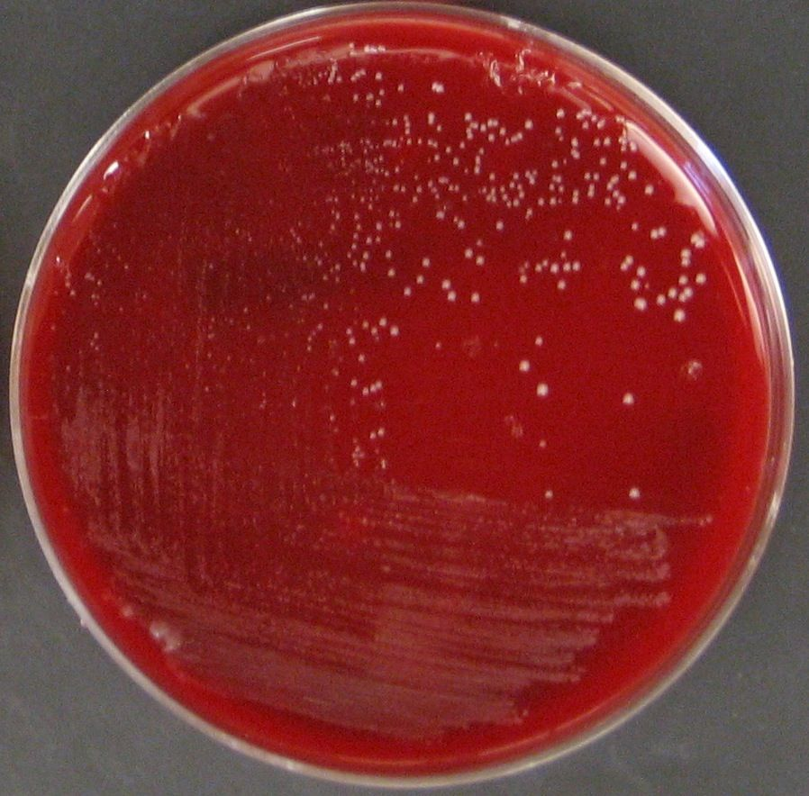 P. Acnes Bacteria